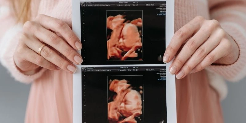 Mơ thấy có bầu sinh con trai